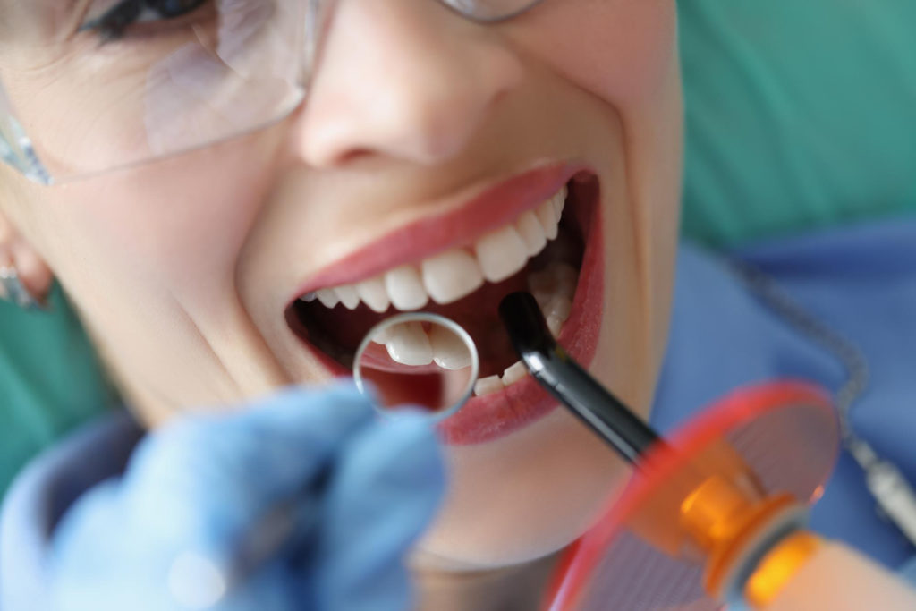 Wybielania zębów nie da się przeprowadzić z dnia na dzień - zabieg musi poprzedzać wizyta u stomatologa, który wyda dalsze zalecenia i określi, czy wybielanie jest możliwe do wykonania
