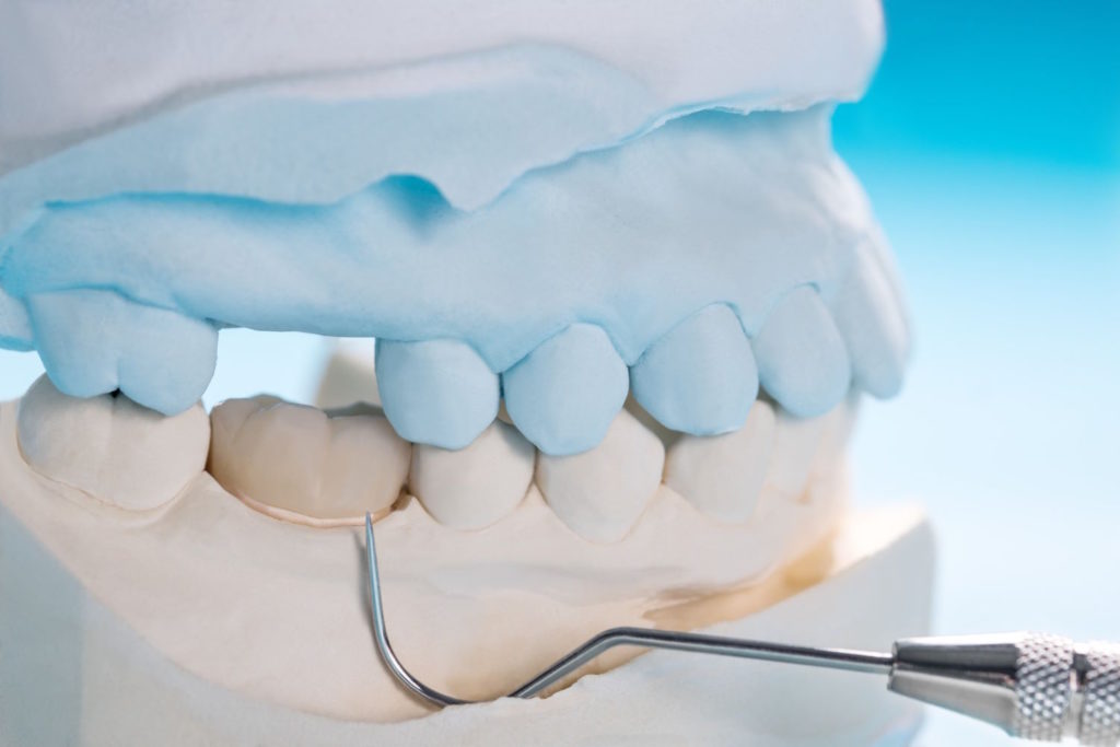 Protezy zębowe są doskonałym rozwiązaniem dla osób, które borykają się z brakiem kilku lub wszystkich zębów